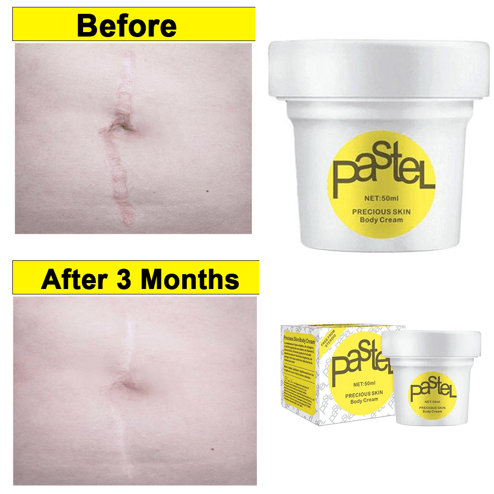 दाग,धर्सा १००% ग्यारन्टीको साथ हटाउने क्रिम Pastel Mark Repair Cream 50ml